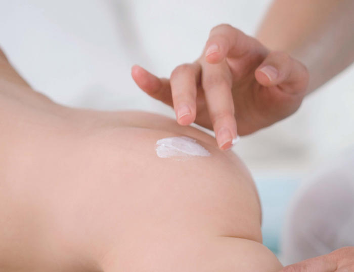 Dermatite atopica nel neonato: di cosa si tratta? come intervenire?