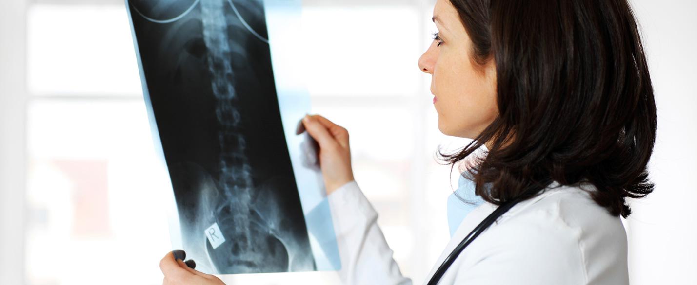Analizzare la postura con la Radiografia della colonna lombo-sacrale
