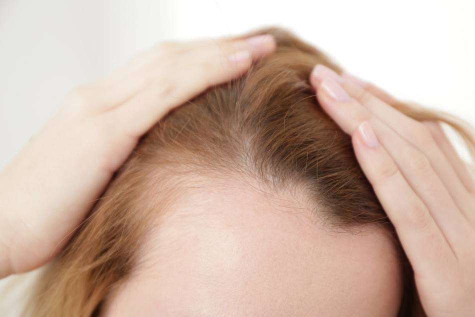 Perdita dei capelli? Rivolgiti al dermatologo
