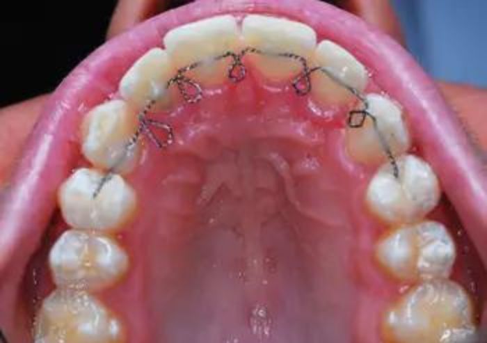 ortodonzia 3