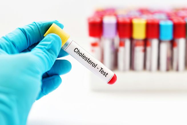 L’importanza dell’esame del colesterolo