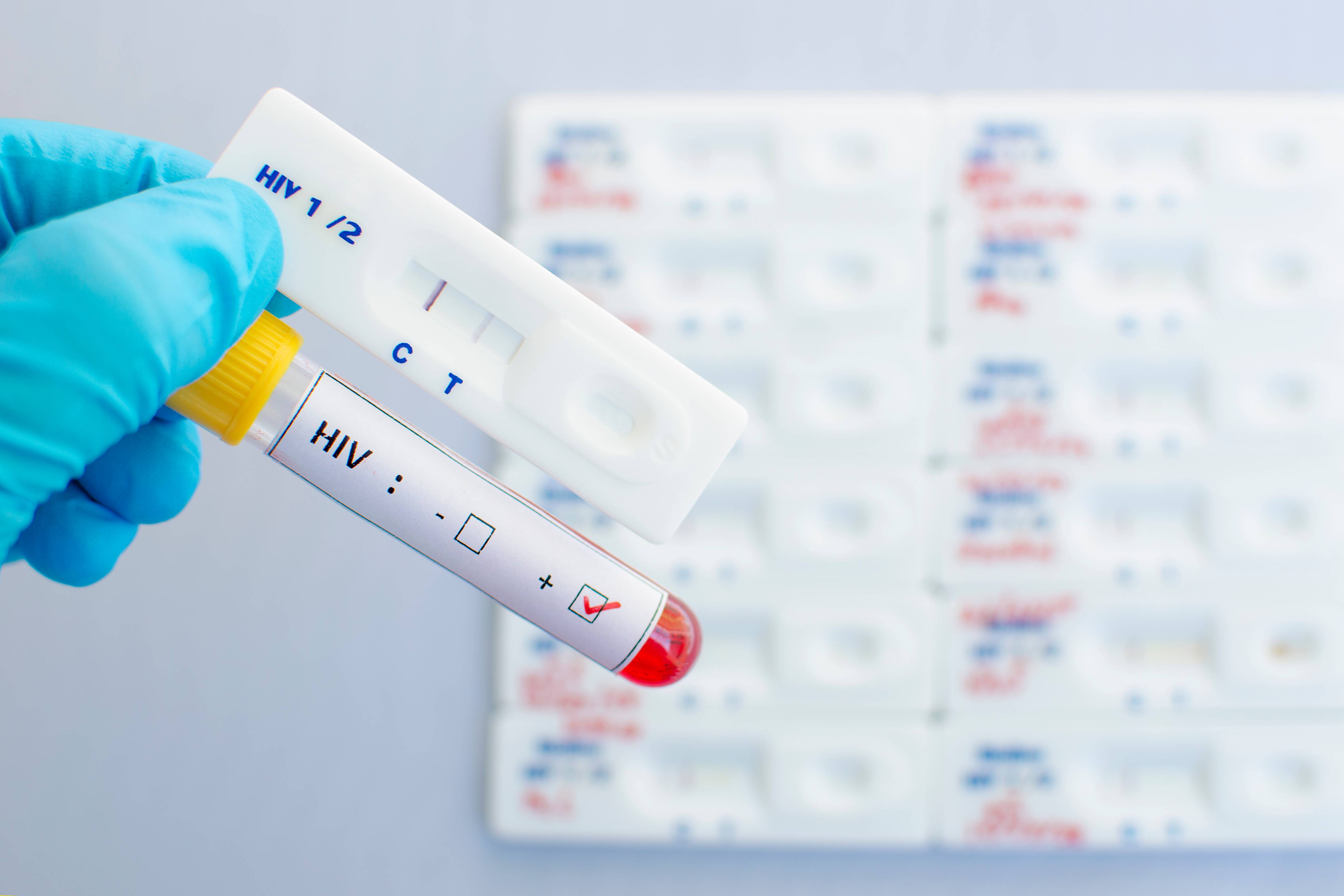 test rapido anonimo mst malattie sessualmente trasmesse hiv hcv hbv sifilide